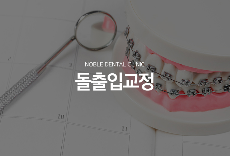 수원 돌출입교정 대표 안내 - 돌출입은 앞니의 기울기와 위치, 치조골과 턱뼈의 형태, 입술 두께와 얼굴 비율이 함께 영향을 줍니다. 교정치료는 단순히 치아를 뒤로 넣는 것이 아니라 얼굴과 교합, 치아 뿌리의 안전한 이동 범위를 함께 평가해야 합니다.