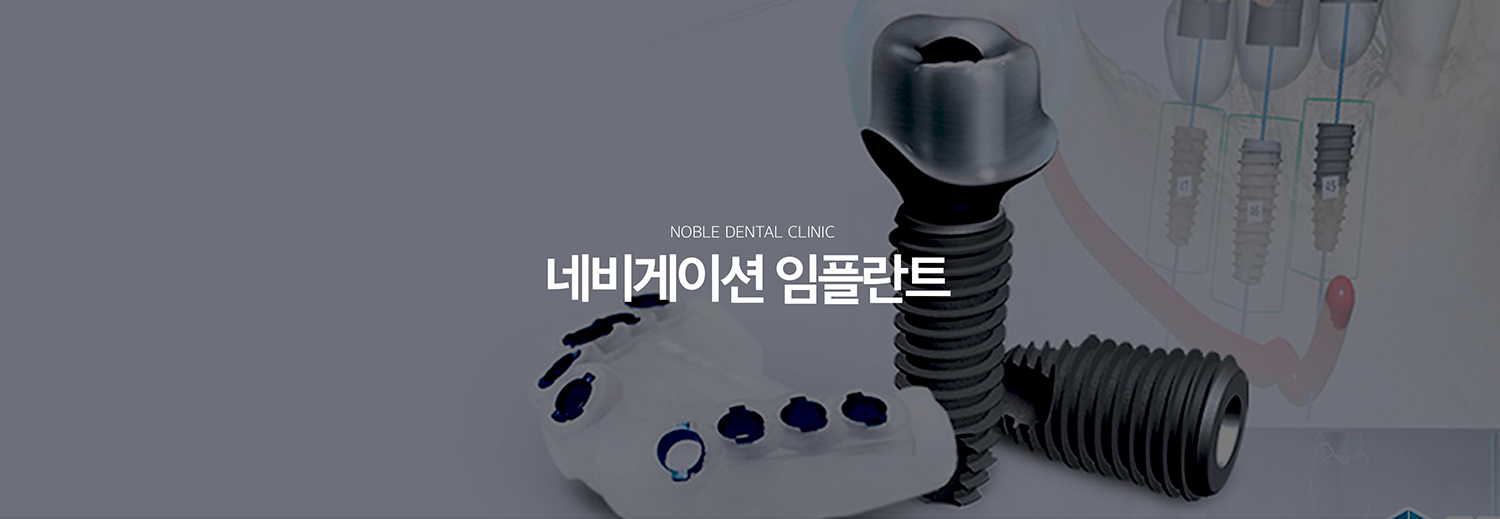 수원 네비게이션 임플란트 대표 안내 - 네비게이션 임플란트는 3D 영상 자료와 구강 정보를 바탕으로 임플란트 위치와 방향을 사전에 계획하고, 필요한 경우 수술 가이드를 활용하는 방식입니다. 가이드 사용 자체보다 잇몸뼈와 주변 구조, 최종 보철 위치를 정확히 평가하는 진단 과정이 중요합니다.