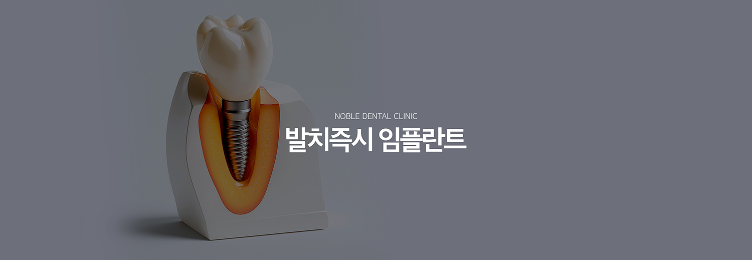 수원 발치즉시 임플란트 대표 안내 - 발치즉시 임플란트는 치아를 뺀 자리에 같은 시기에 임플란트 식립을 고려하는 치료 방식입니다. 모든 발치 부위에 적용할 수 있는 것은 아니며 염증 범위, 남아 있는 뼈의 형태, 초기 고정 가능성, 잇몸 상태를 먼저 평가해야 합니다.