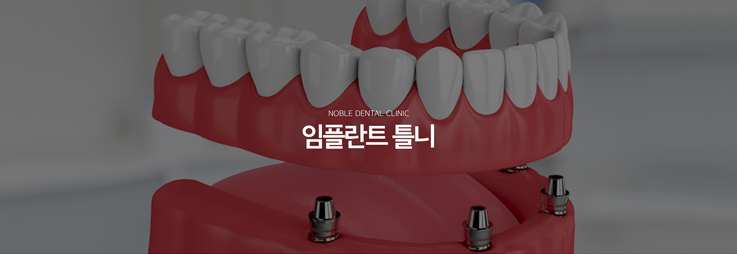 수원 임플란트 틀니 대표 안내 - 임플란트 틀니는 여러 치아가 상실된 경우 소수의 임플란트를 틀니의 지지와 유지에 활용하는 치료 방식입니다. 남아 있는 치아와 잇몸뼈, 현재 사용하는 틀니의 상태, 씹는 힘과 위생관리 능력을 함께 평가해 치료계획을 세웁니다.