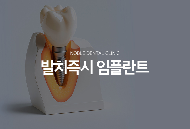 수원 발치즉시 임플란트 대표 안내 - 발치즉시 임플란트는 치아를 뺀 자리에 같은 시기에 임플란트 식립을 고려하는 치료 방식입니다. 모든 발치 부위에 적용할 수 있는 것은 아니며 염증 범위, 남아 있는 뼈의 형태, 초기 고정 가능성, 잇몸 상태를 먼저 평가해야 합니다.