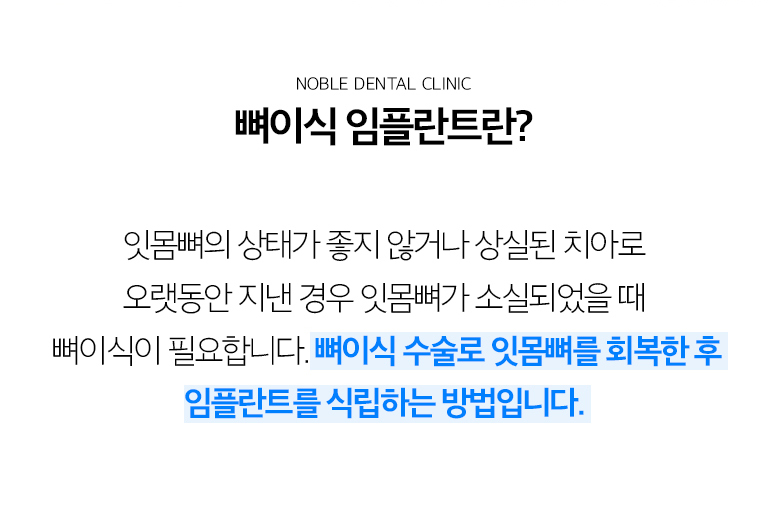 수원 뼈이식 임플란트 상세 안내 - 잇몸뼈는 왜 부족해질까요? - 치아를 잃은 뒤 오랜 시간이 지나거나 치주질환으로 뼈가 소실된 경우, 염증이 심했던 치아를 발치한 경우, 원래 뼈 폭이 좁은 경우 등 여러 원인으로 임플란트 부위의 뼈가 부족할 수 있습니다. / CT와 구강검사에서 확인하는 것 - 뼈의 폭과 높이, 결손 방향, 상악동과 신경관 위치, 주변 치아와 잇몸 상태를 확인합니다. 필요한 뼈의 양과 이식 범위를 추정한 뒤 임플란트와 동시에 진행할지 먼저 뼈이식을 할지 결정합니다.
