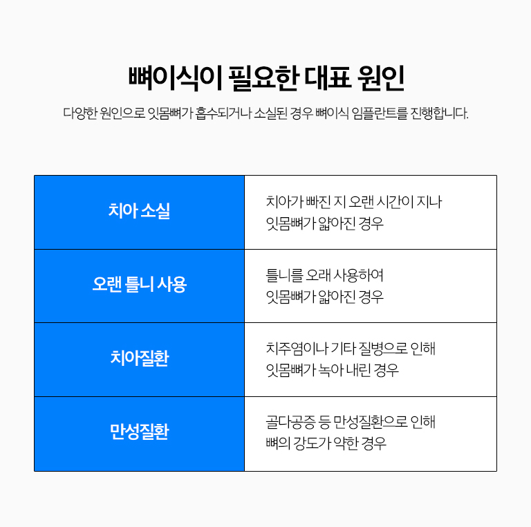 수원 뼈이식 임플란트 상세 안내 - 이식재와 차폐막의 역할 - 골이식재는 결손 부위를 보완하는 데 사용하며 상황에 따라 차폐막 등 보조재료를 사용할 수 있습니다. 어떤 재료를 사용할지는 결손 크기, 위치, 환자 상태와 치료계획을 종합해 결정합니다. / 치료 과정 - 영상검사와 치료계획, 염증 조절, 뼈이식 또는 임플란트 식립, 치유상태 확인, 보철 순서로 진행합니다. 발치가 필요한 경우 발치 시점과 뼈이식 시점을 함께 계획합니다.
