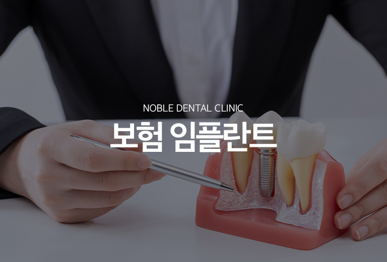 수원 건강보험 임플란트 대표 안내 - 건강보험 임플란트는 보험 기준을 충족하는 경우 정해진 절차에 따라 적용할 수 있습니다. 연령과 치아 상태, 과거 보험 임플란트 이용 이력 등 확인이 필요하며, 뼈이식과 같은 추가 치료는 별도 기준이 적용될 수 있어 상담 시 구분해 안내받는 것이 좋습니다.