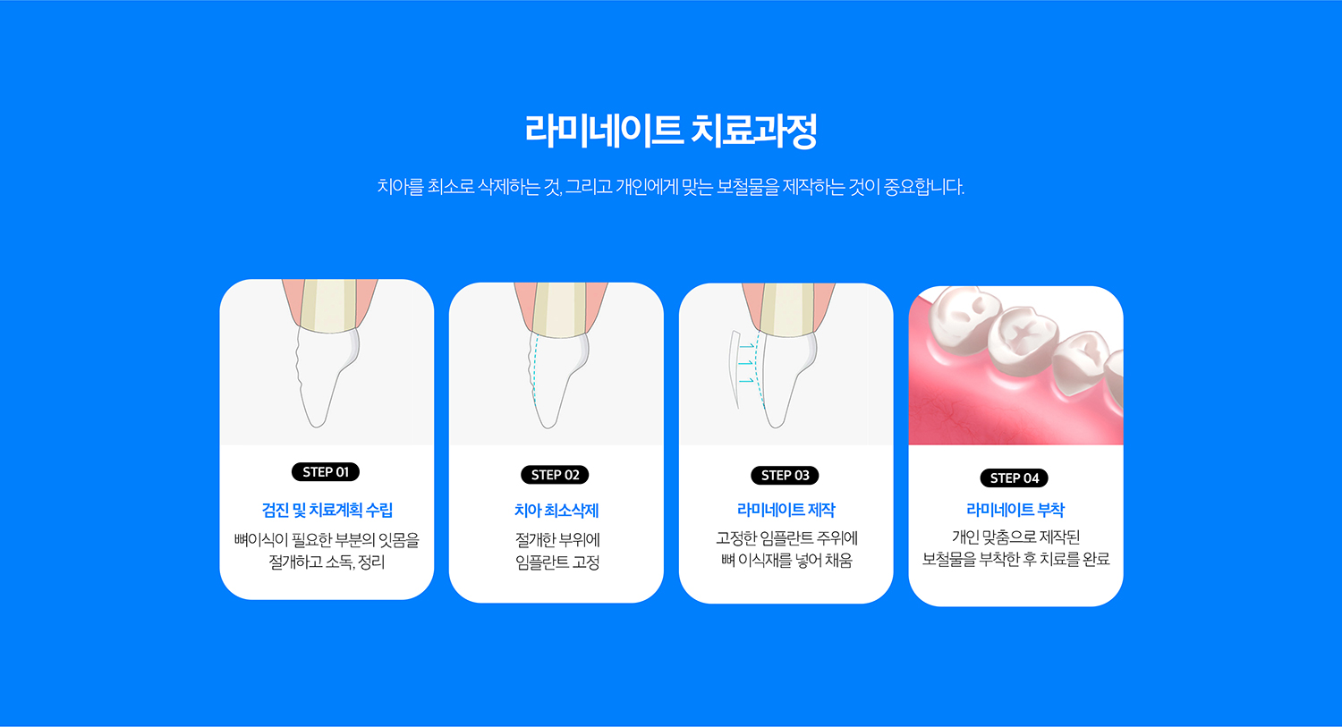수원 라미네이트 상세 안내 - 교정·미백·레진과 비교 - 치아 위치가 문제라면 교정, 색만 문제라면 미백, 작은 파절이나 형태 수정은 레진 치료가 더 보존적일 수 있습니다. 필요한 변화의 종류에 따라 치료를 비교합니다.