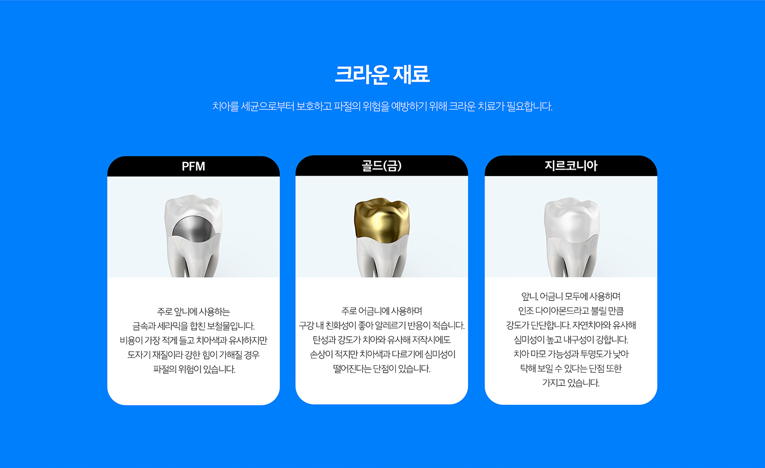 수원 크라운 치료 상세 안내 - 보철 재료 선택 - 치아 위치와 심미 요구, 교합력, 맞은편 치아와의 관계에 따라 재료를 선택합니다. 특정 재료가 모든 위치에 가장 좋은 것은 아니므로 기능과 심미를 함께 비교합니다.
