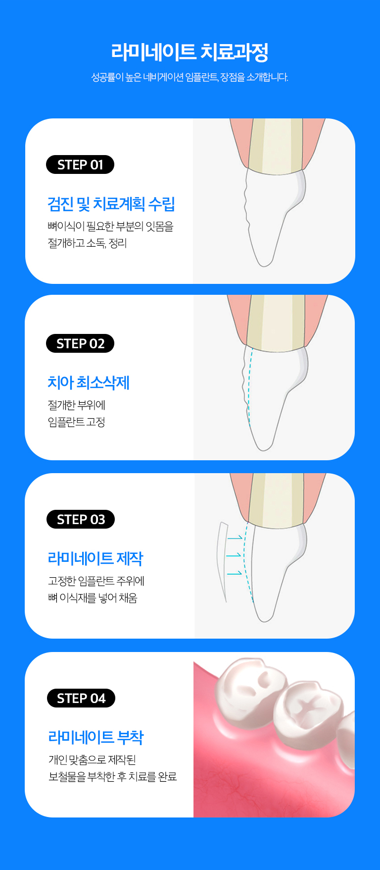 수원 라미네이트 상세 안내 - 교정·미백·레진과 비교 - 치아 위치가 문제라면 교정, 색만 문제라면 미백, 작은 파절이나 형태 수정은 레진 치료가 더 보존적일 수 있습니다. 필요한 변화의 종류에 따라 치료를 비교합니다.