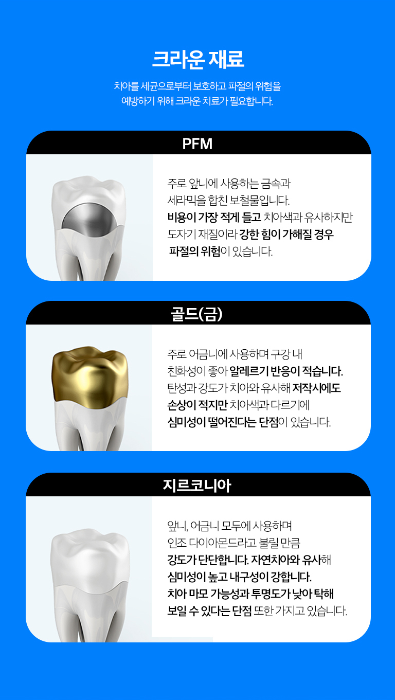 수원 크라운 치료 상세 안내 - 보철 재료 선택 - 치아 위치와 심미 요구, 교합력, 맞은편 치아와의 관계에 따라 재료를 선택합니다. 특정 재료가 모든 위치에 가장 좋은 것은 아니므로 기능과 심미를 함께 비교합니다.