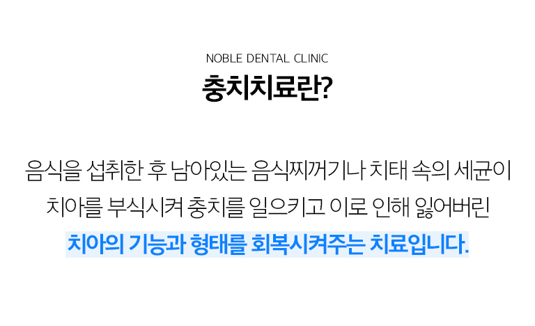 수원 충치치료 상세 안내 - 충치 진행 단계와 증상 - 초기 충치는 통증이 거의 없을 수 있고 상아질까지 진행하면 차갑거나 단 음식에 시릴 수 있습니다. 신경 가까이 진행되면 자발통이나 오래 지속되는 통증이 나타날 수 있습니다. / 검사에서 확인하는 내용 - 육안검사와 방사선 자료, 충치 범위와 치아 파절 여부를 확인합니다. 기존 충전물 아래 재충치나 치아 사이 충치는 겉으로 잘 보이지 않을 수 있습니다.