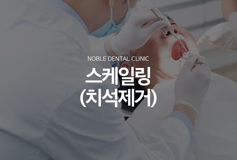 수원 스케일링 대표 안내 - 스케일링은 치아와 잇몸 경계에 단단하게 붙어 칫솔로 제거하기 어려운 치석과 치태를 제거하는 기본적인 잇몸 관리입니다. 치석이 깊은 잇몸 아래까지 형성되고 치주질환이 진행된 경우에는 스케일링만으로 충분하지 않을 수 있습니다.